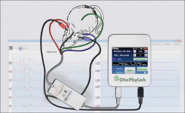 OtoPhyLab ABR-Modul